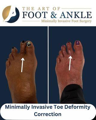 The Art of Foot and Ankle