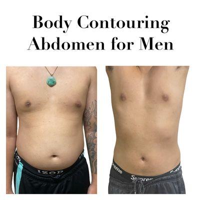 Body contouring for men. Loose inches within a few sessions, non invasive procedure.