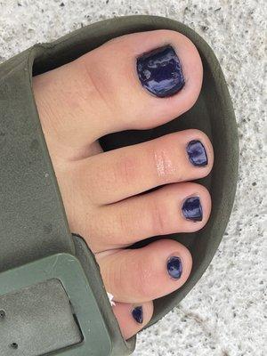 lumpy pedicure, and polish all over skin