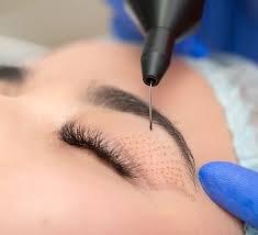 PlasmaLift Skin Tightening