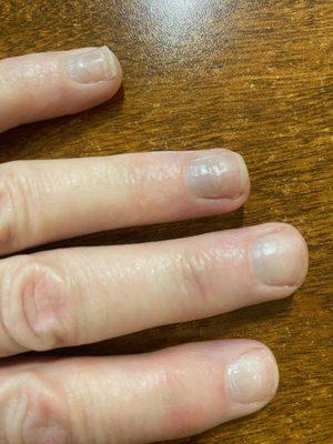 Drilled removal of tips 4 weeks later product still on nails.