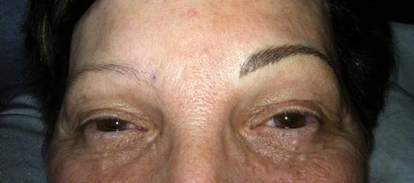 Full Brow Makeover half way completed