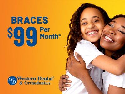 Braces $99 Per Month