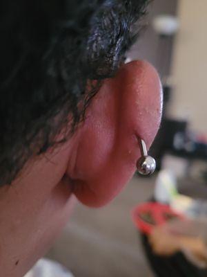 Clear migration of piercing.