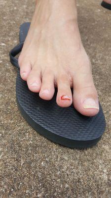 No excuse for such torture. Butchered and bleeding from a pedicure at Bliss Nail Salon.