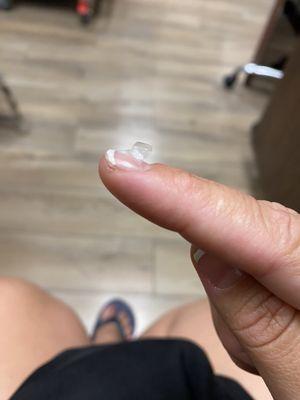 Peeling nail