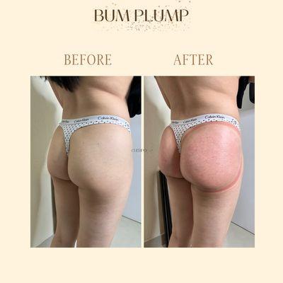 Plump your Bum for summer