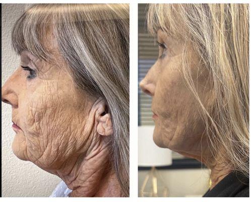 Dermacare Non-Surgical Face & Body Sculpting