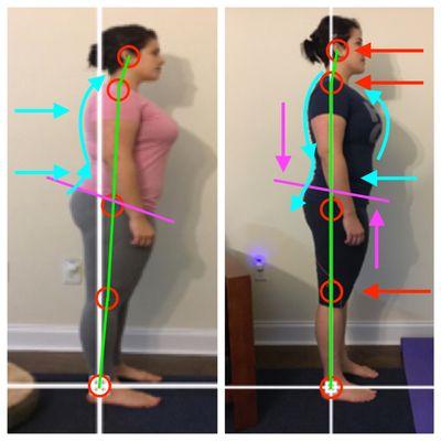 Correcting pelvic tilts to adjust body position and balancing hips.