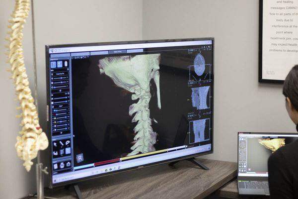 3D x-rays reveal details (as small as 0.1 millimeter) that may have been missed in other healthcare offices that make all the difference.