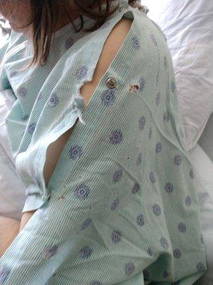 Hospital gown