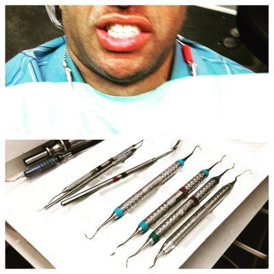 Periodontal maintenance in the morning! #healthylifestyle #necessity #dentist #oralhealth #priorities #greatexpressions