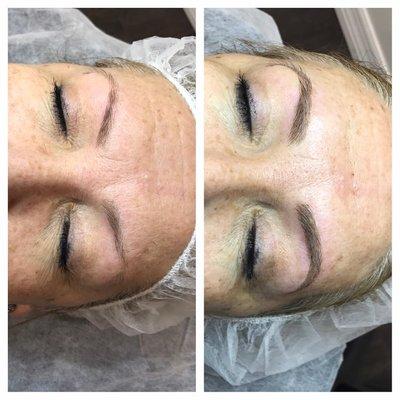 Before & After Microblading