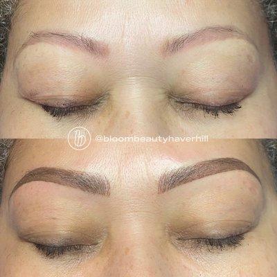 Brow Correction-Combination Brows