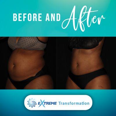 Extreme Transformation Program - Before and After