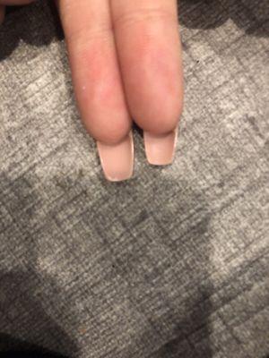 Shorter pinky nail next to other pinky