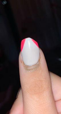 my nail before it fell off.