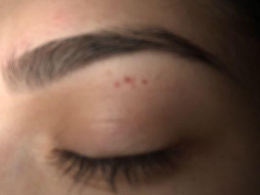 Cuts under my brow