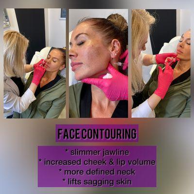 Face Contouring with dermal fillers!!!!