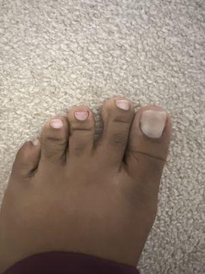 My toenails were fully in tact and straight before I went, this is the after. I didn't even let them polish them because they were ugly.