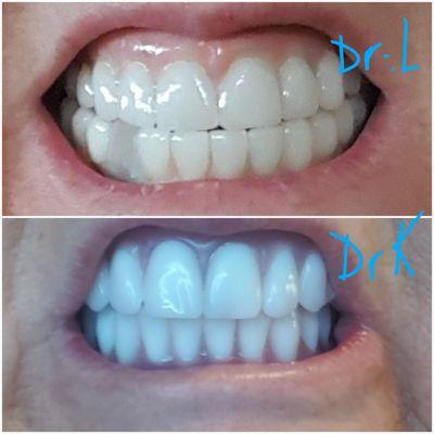 Front Range Dentures and Prosthodontics