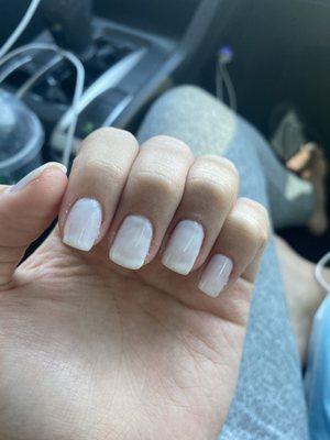 Ugly nails