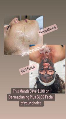 Save $100 on Combo Treatment: Dermaplaning Plus Glo2 Facial for extra Glow!