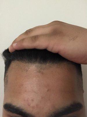 Fucking hairline is not even cleaned up properly