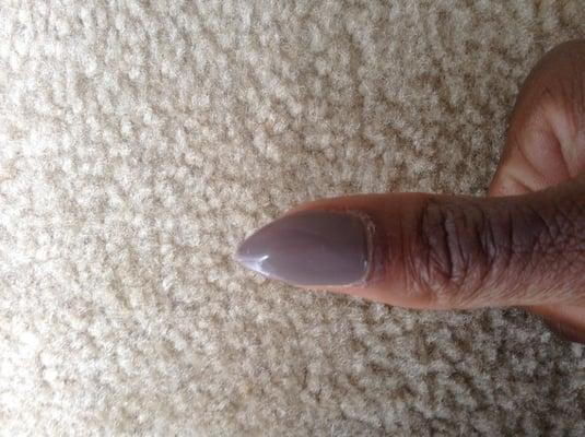 Nail glue on skin. fingernail angled left.