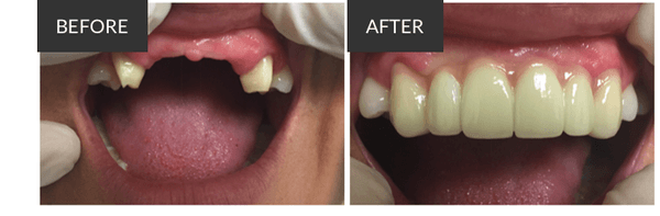 Restorative Dentistry