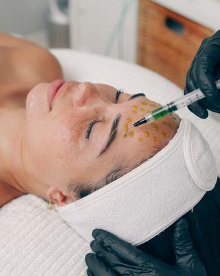 BioRePeel in The Peel+ Facial