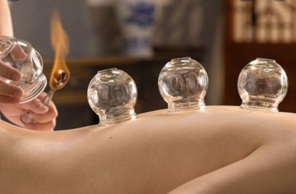 Cupping