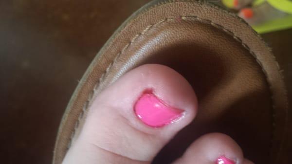 My sister-in-law's bleeding big toe and subpar paint job. They clearly didn't GAF.