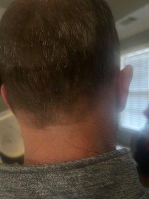 Back of head