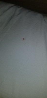 We found blood on the pillow