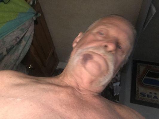 Jerry gray 04/21/1955 please call in pain meds you removed 5 teeth Fri thank you