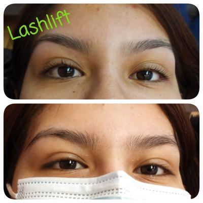 Lashlift