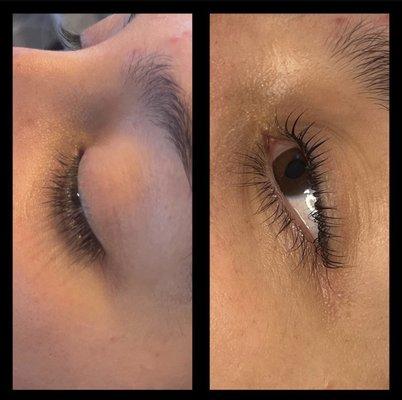 Eyelash lift