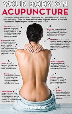 Just some reasons to get acupuncture.