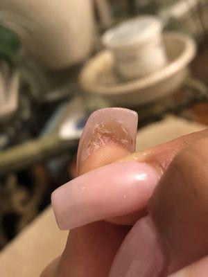 More acrylic hanging off nail after applying acrylic she did not fix underneath to straighten out nail remained thick and my skin was stuck