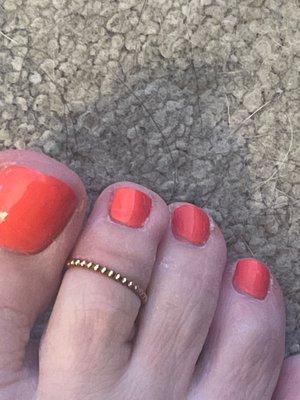 Toe ring