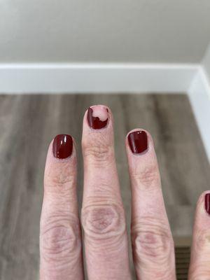 Within less than 24 hours, almost an entire nail came off.