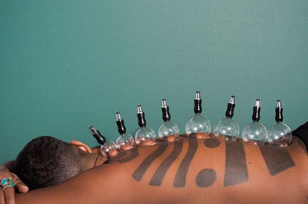 We offer other services such as cupping, reiki, herbal nutrition, and crystal ear seeds.