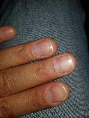 Cuticles look terrible after manicure, and the ridges are still there. I've never had my hand look like this AFTER a manicure.