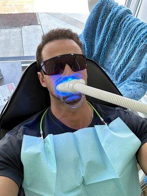 Teeth whitening session