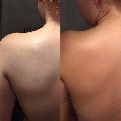 Before and after an airbrush spray tan using Venetian sunless solution!