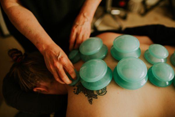 Cupping helps release the tension in the muscles!