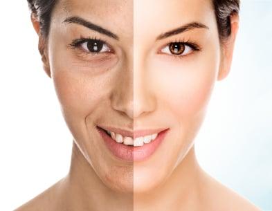 Top of the line Anti-Aging and Skin Rejuvenation Treatments. Reveal your beautiful skin!