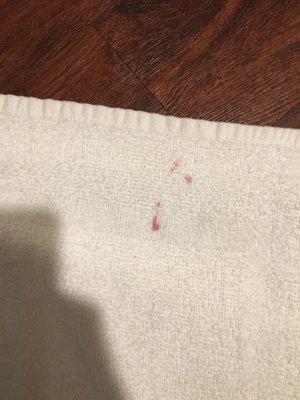 Stain on the bath mat.  It was red but didn't look like blood.