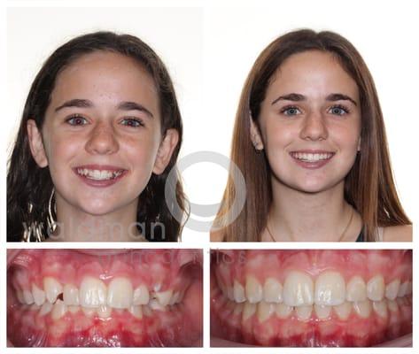 January 2016 Smile of the Month